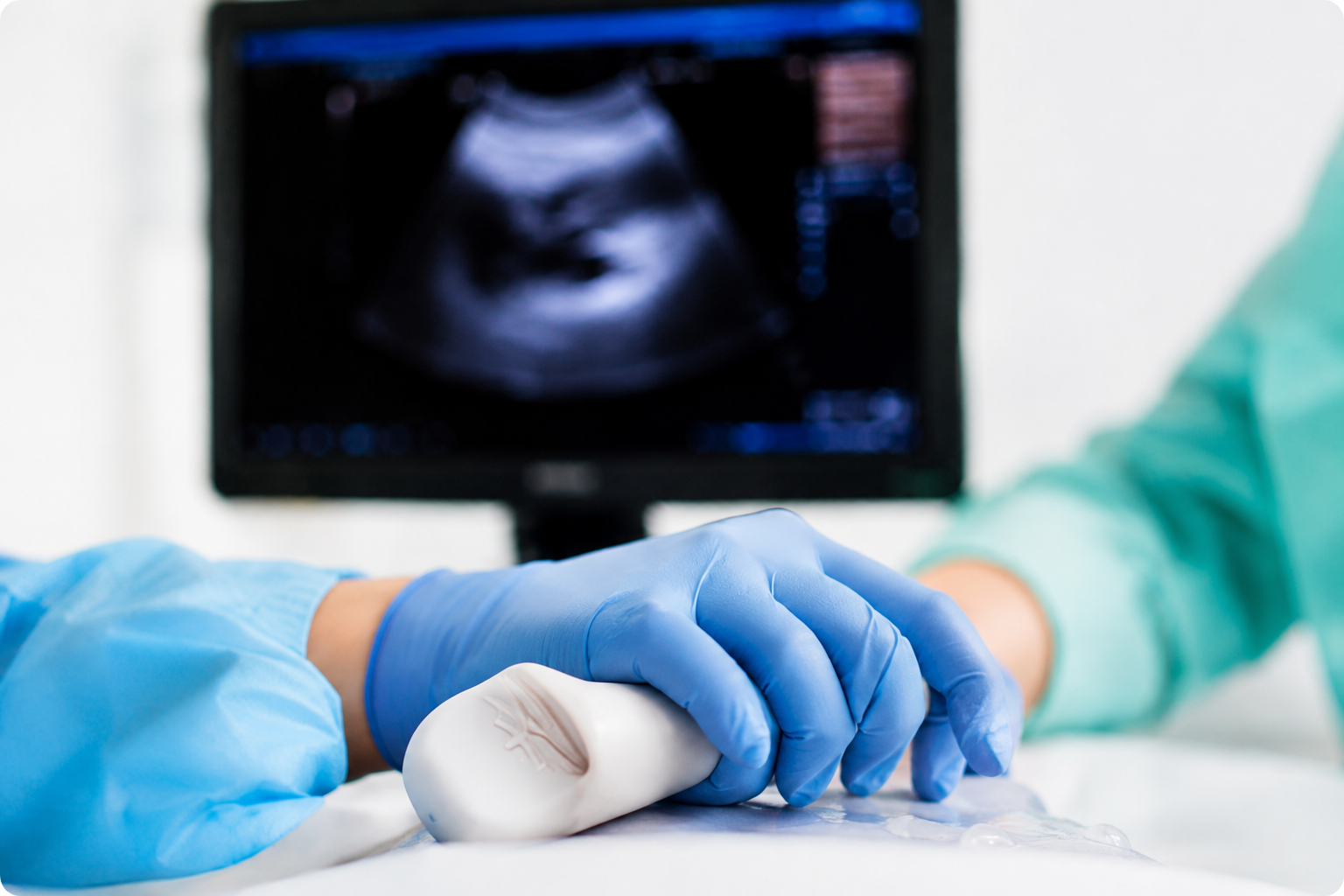 Medical evaluation for ovarian cancer diagnosis