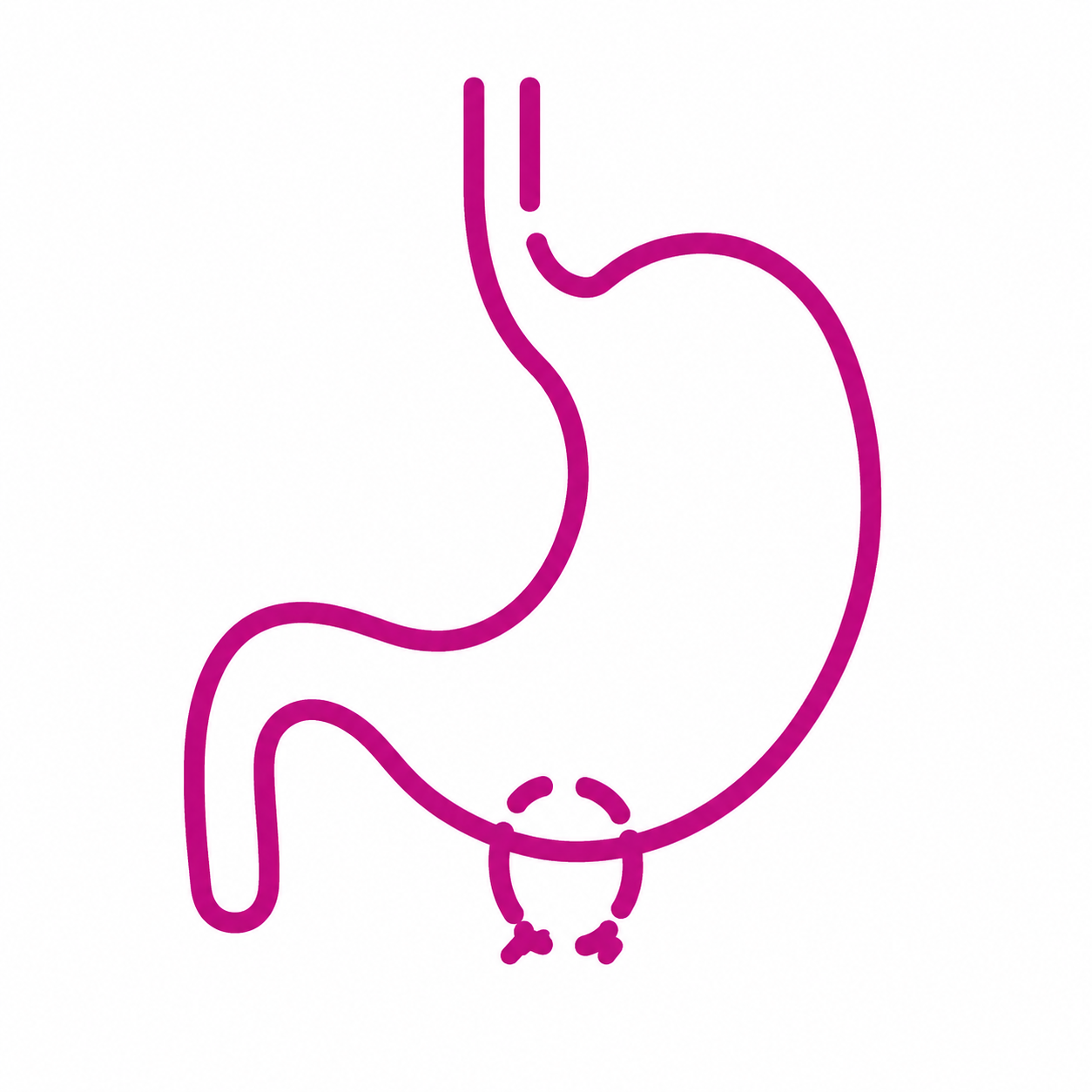 Persistent bloating as a possible symptom of ovarian cancer